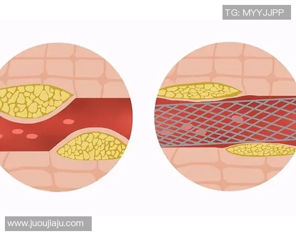 足球明星心脏健康隐患揭秘谁在运动场上面临风险